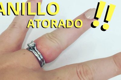 como quitar un anillo en un dedo hinchado